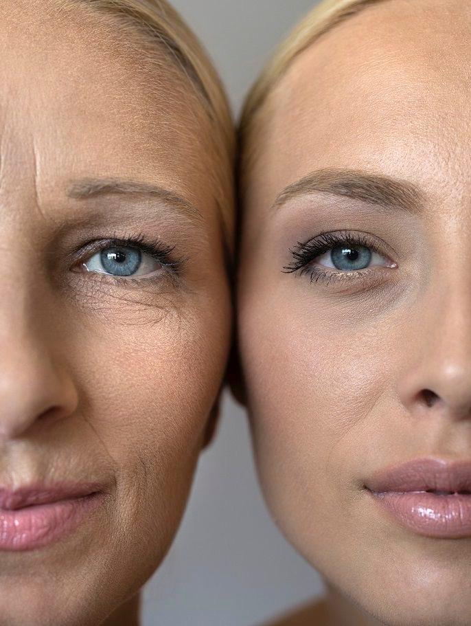 Skin Hydration with Hyaluronic Acid