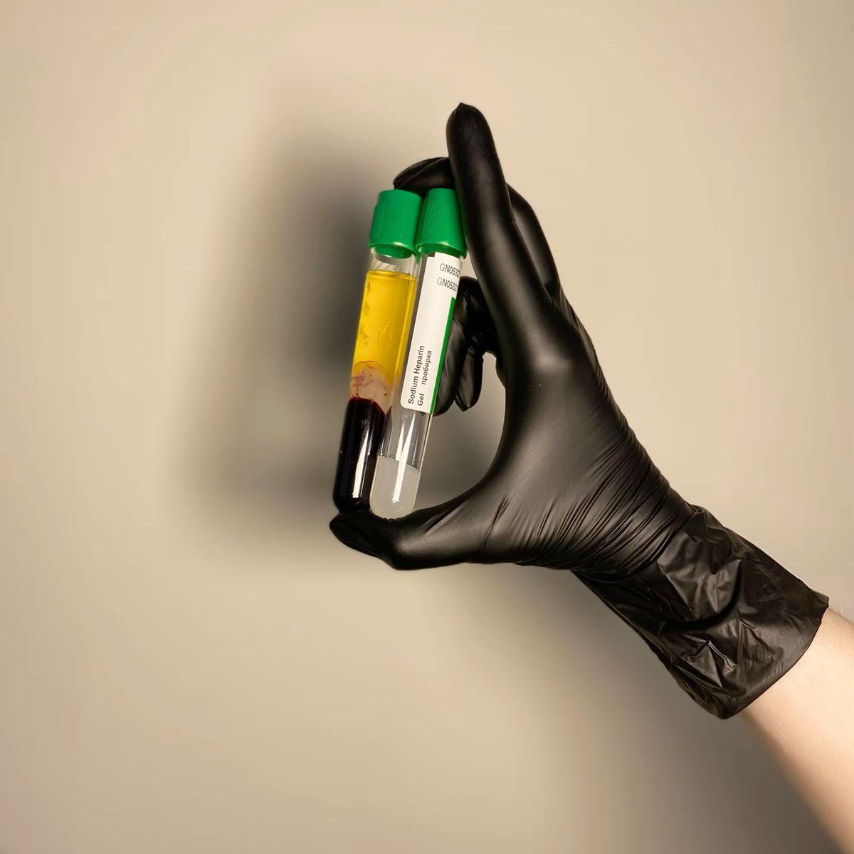 Hyaluronic Acid for the Face